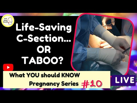 Life Saving C Section Or Taboo What You Should Know Pregnancy Stories