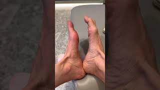 #toe #toeworkout #workout #recovery #sayhi