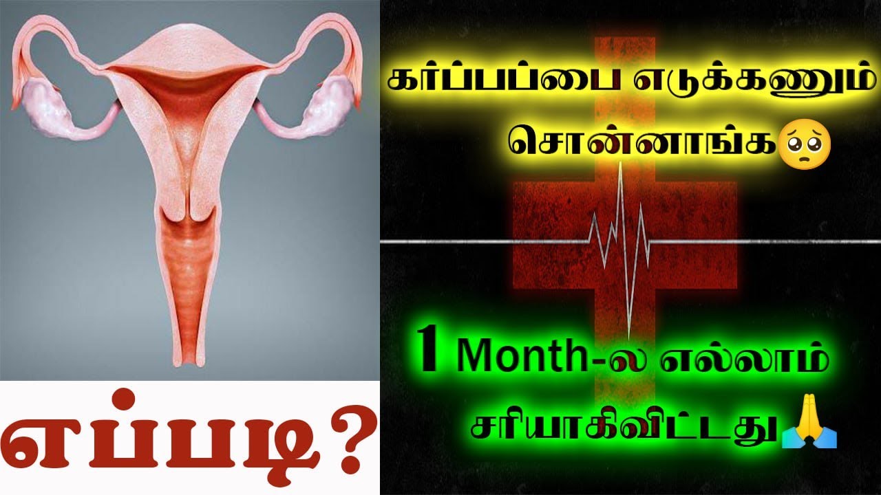PCOD🥺 - Irregular Periods😫| மாதவிடாய் பிரச்சனைகள்? இனி கவலை இல்லை😄| Complete Cure with Evidence 🧐