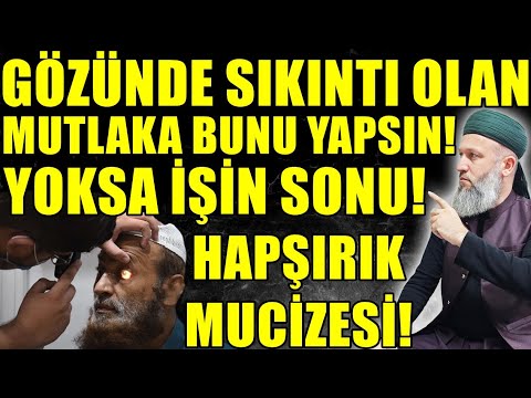 GÖZÜNDE SIKINTI OLANLAR İZLESİN! BUNLARI YAPANLARA MÜJDE! Hüseyin ÇEVİK