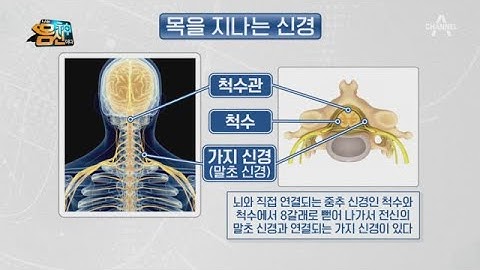 목에 있는 뇌, 