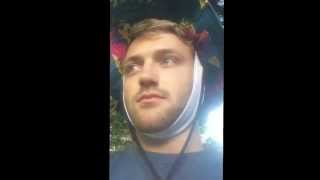 Mitchell Frisby after wisdom teeth removal