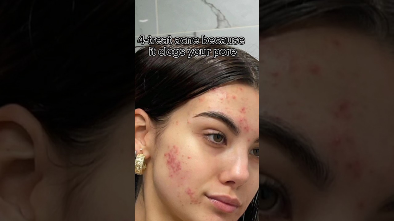 7 tips to get rid of clogged pores😀😯