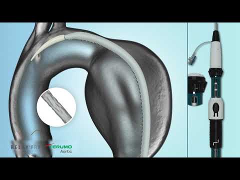 RelayPro NBS   Deployment Animation   Terumo Aortic