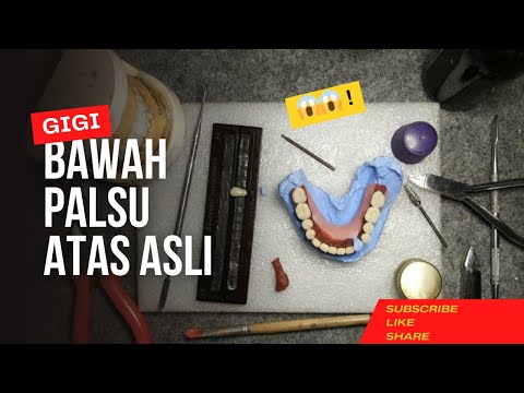 Video: Cara Membuat Gigi yang Longgar Jatuh Tanpa Menariknya: 13 Langkah