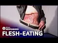 The Flesh-Eating Illness Causing Horrific Destruction | Diagnosis Unknown | Real Responders