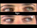 A comparison between HGN and no HGN.