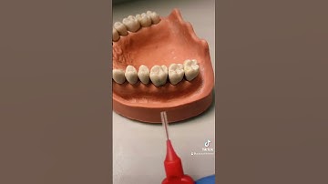 Overcoming common problems with Tepe brushes - they bend when you use them #tepe #dentist #putney