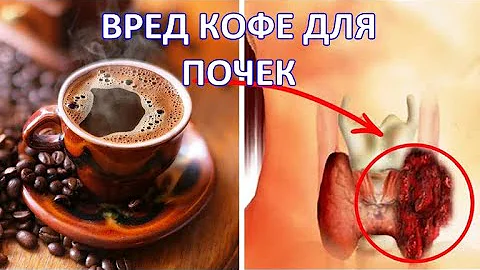 КОФЕ нарушает работу  ПОЧЕК. Мочегонное действие КОФЕИНА / Фролов Ю.А.