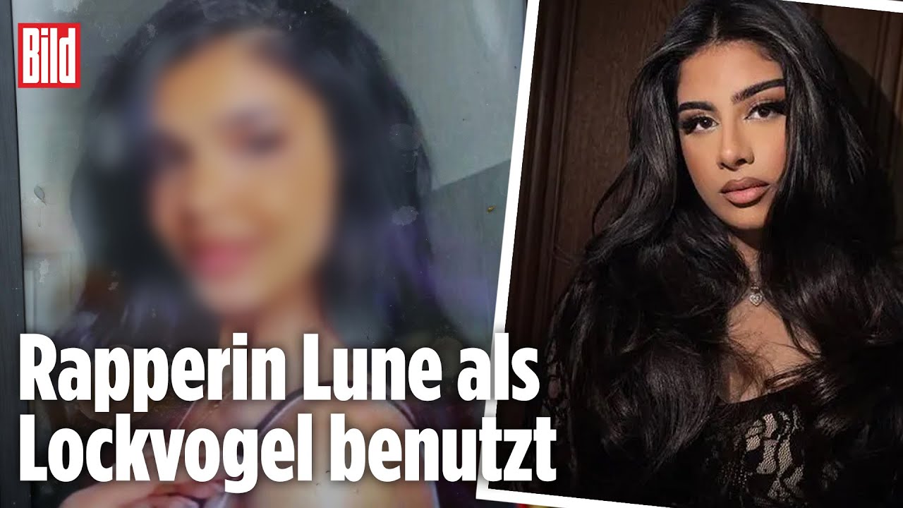 Beauty Guru (21) mit Horror Maniküre! Gelnägel mega entzündet! | Klinik am Südring | SAT.1 TV