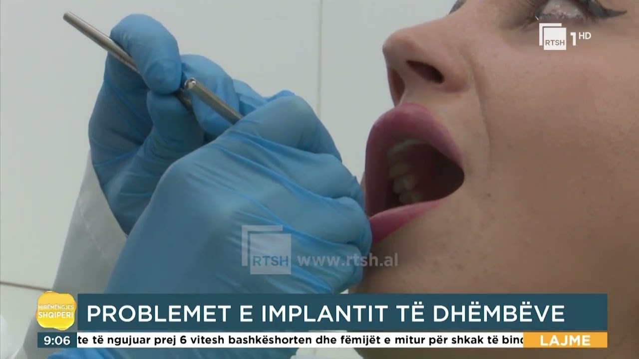 Klarisa Rexhvelaj: Implantet dentare, rastet kur nuk duhen përdorur|