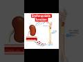erythropoietin function in RBC production #hematology #oncology #pathology #hormones #anatomy #dmlt