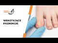 Wrastające paznokcie | Poradnia Chorób Stopy