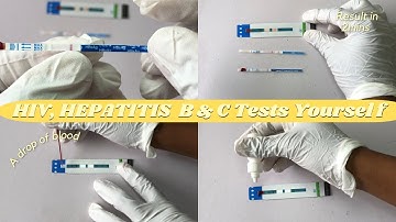 HOW TO | HIV, HEPATITIS B & C strip TESTS yourself at HOME!