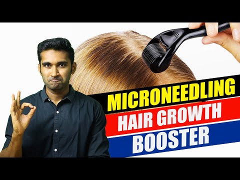 How to do MICRO-NEEDLING at home for HAIR GROWTH?.(தமிழ்) #tamil #haircare #hairgrowth #hairloss