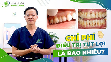 ĐIỀU TRỊ TỤT LỢI CHÂN RĂNG HẾT BAO NHIÊU TIỀN ??
