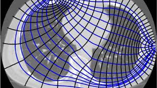 Electrical impedance tomography | Wikipedia audio article screenshot 1