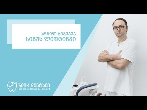 სინუს ლიფტინგი - იმპლანტაციისთვის მოსამზადებელი ეტაპი