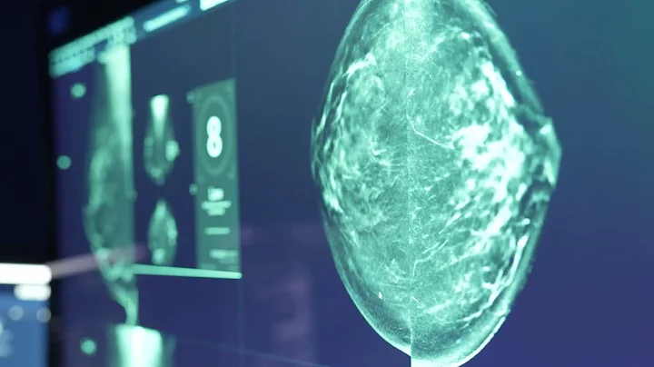 How AI Is Revolutionizing Breast Cancer Detection | Dr. Onalisa Winblad Explains
