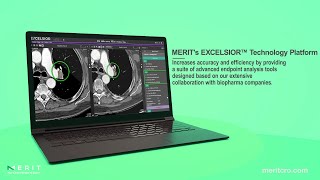 EXCELSIOR Software Client Benefits screenshot 2