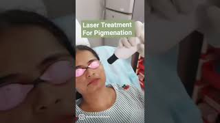 Pigmentation Removal || Laser For Pigmenation || How to Remove Tanning