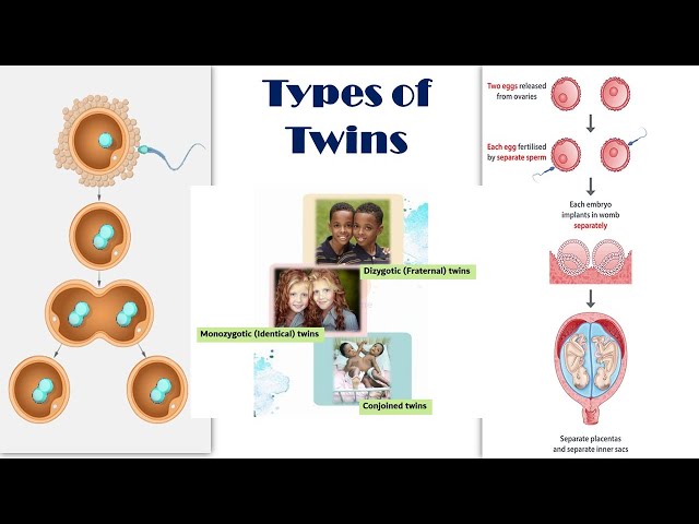 Types of Twins | Dizygotic (Fraternal) vs Monozygotic (Identical) Twins | Conjoined twins - YouTube