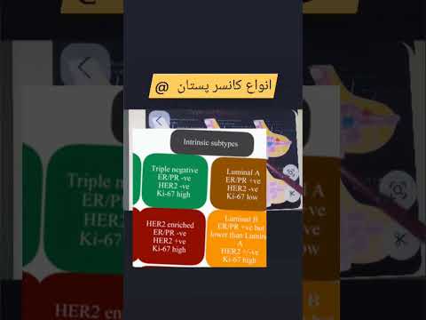 سرطان پستان و گیرنده های سه گانه سطح تومور پیش آگهی و درمان سرطانپستان سهگانه منفی هورمون