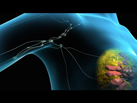 Breast Cancer | Tumor Removal Surgery | Nucleus Health