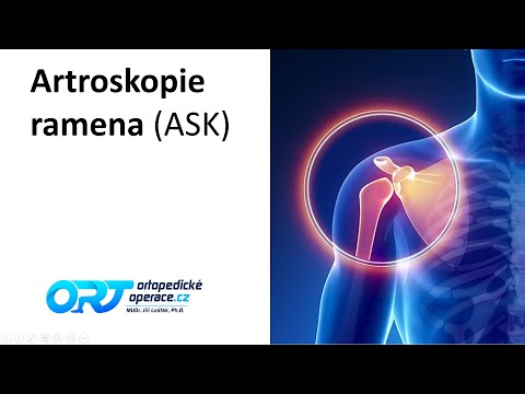 Artroskopie ramena - jaké jsou artroskopické možnosti ošetření ramena?