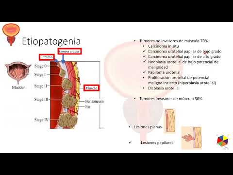 Epidemiologia del carcinoma