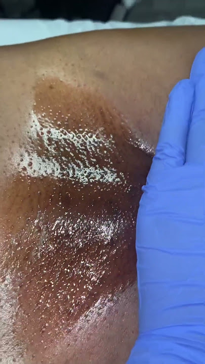 BRAZILIAN WAX | HOUSTON WAXER | HOUSTON ESTHETICIAN
