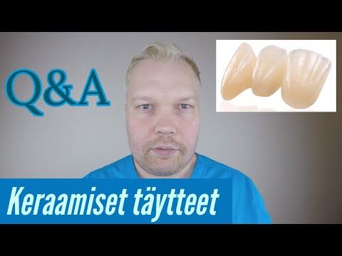 Video: Hammasviilut: Kustannukset, Toimenpide Vs. Kruunu, Implantit Ja Muut