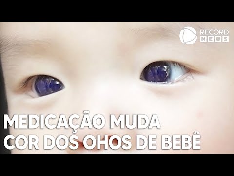 Medicação muda cor dos olhos de bebê durante tratamento da Covid-19