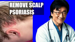 Remove Scalp Psoriasis - Best At Home Treatment screenshot 5