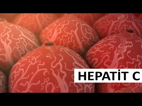 Daşıyıcı hepatit sağalırmı? - Hepatit C xəstəliyi
