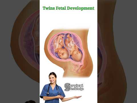 Video: Forårsager bicornuate uterus tvillinger?