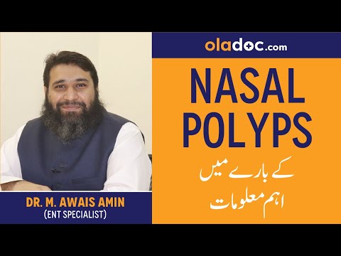 What Are Nasal Polyps Kya hota hain | Urdu Hindi | An Overview | Nasal Polyps Symptoms thumbnail image