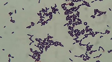 Gram staining of Enterococcus durans