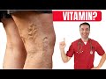 1 VITAMIN For Preventing VARICOSE VEINS 