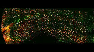 Expanded Hippocampus of Thy1-GFP transgenic-mice