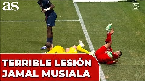 La LESIÓN de MUSIALA que LAMENTA el MUNDO ENTERO | la REACCIÓN de DONNARUMMA