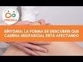 El síntoma: La forma de descubrir que cadena miofascial está afectando - Kinésica