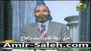 تمزق أربطة القدم الأسباب والعلاج | الدكتور أمير صالح | الطب الآمن