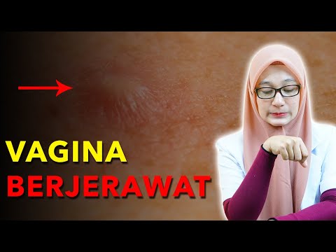 Video: Jerawat Vagina: Penyebab, Pengobatan, Dan Banyak Lagi