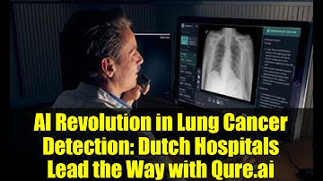 AI Revolution in Lung Cancer Detection: Dutch Hospitals Lead the Way with Qure.ai