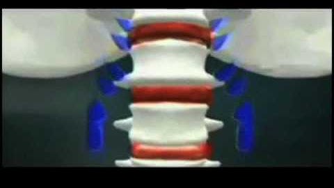 Teeter Hang Ups Inversion Table