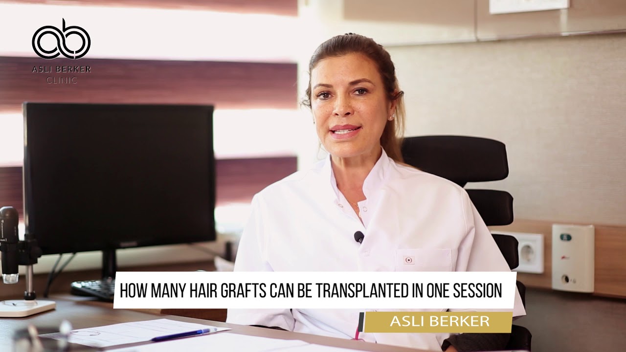 How Many Hair Grafts Can Be Transplanted In One Session