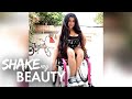 I'm 26 And I've Broken 400 Bones | SHAKE MY BEAUTY