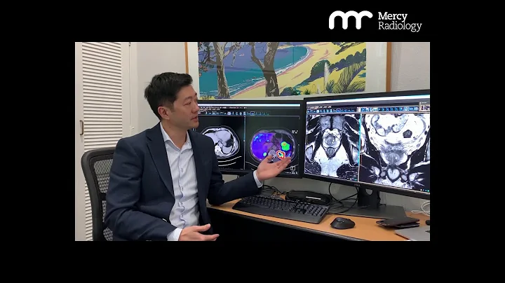 Dr Remy Lim: Who is a radiologist? | Mercy Radiology