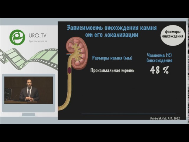 Гаджиев Н К - Что делать с камнем мочеточника?